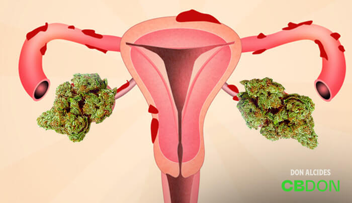 Cannabis e endometriose